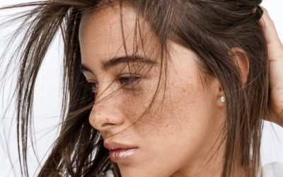 Enjoy Freckles – Age Spots Are a Different Matter