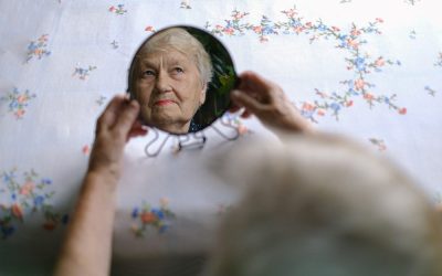 Concerned About Age Spots?