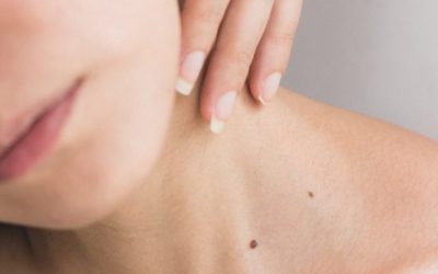 Avoid “Cigarette-Paper” Skin
